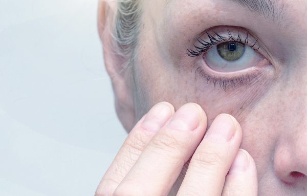 Como lidar com o problema ocular olho seco?